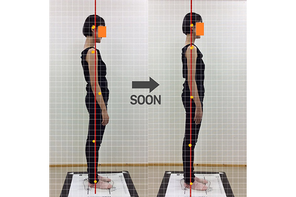 姿勢画像検査1回の施術で効果を実感