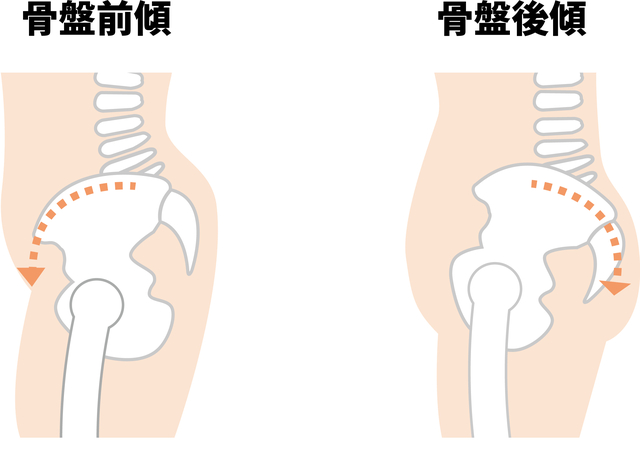 反り腰でよく起きる症状とは 原因と治し方を解説します 伊集院整骨院